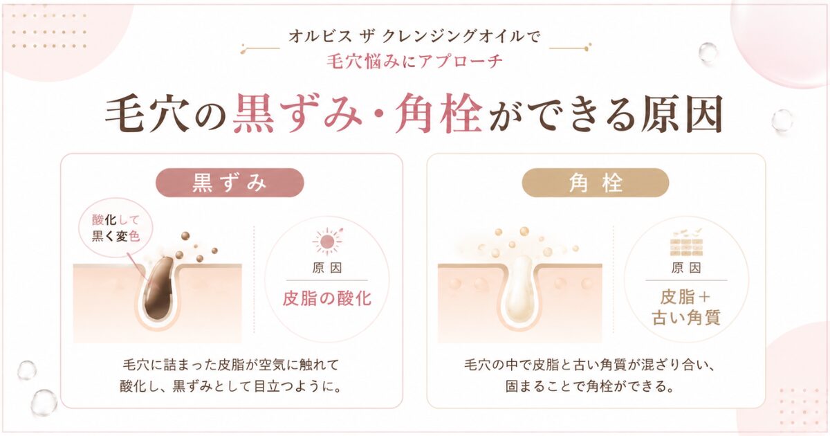 毛穴の黒ずみ・角栓ができる原因のイメージ